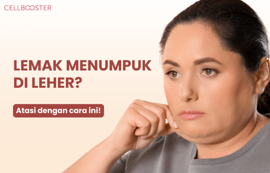 Cara Menghilangkan Lemak di Leher