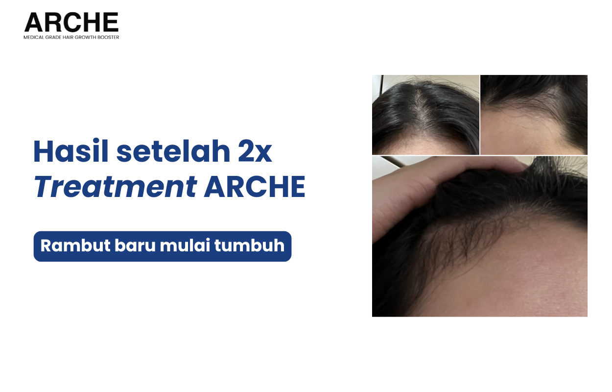 Treatment ARCHE