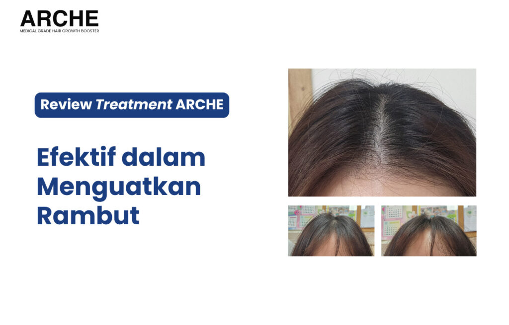 Perawatan untuk Rambut Rontok