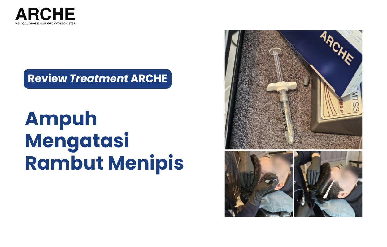 ARCHE - Solusi Ampuh untuk Mengatasi Rambut Menipis