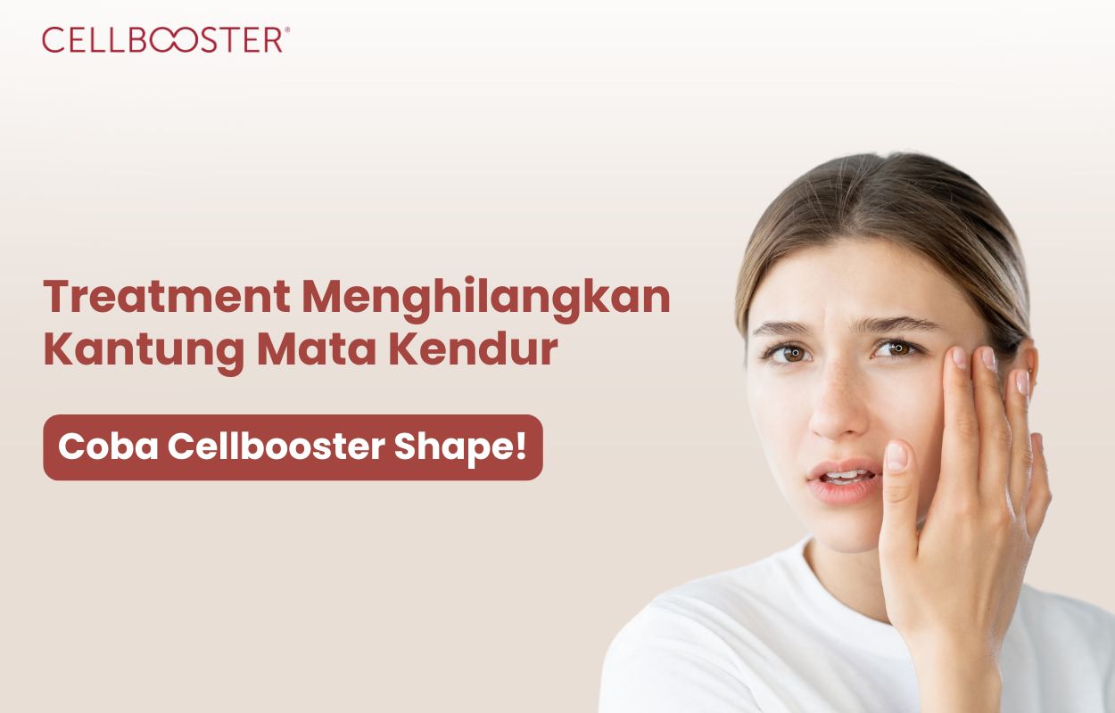 treatment menghilangkan kantung mata