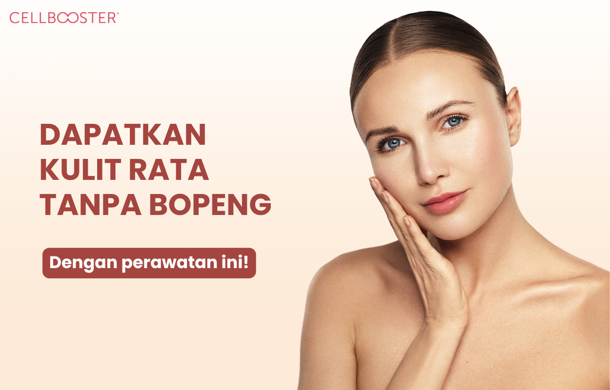 Cara Mengatasi Muka Bopeng