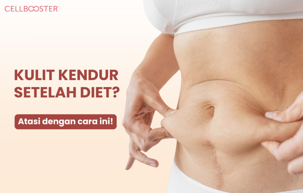 Kulit Kendur setelah Diet