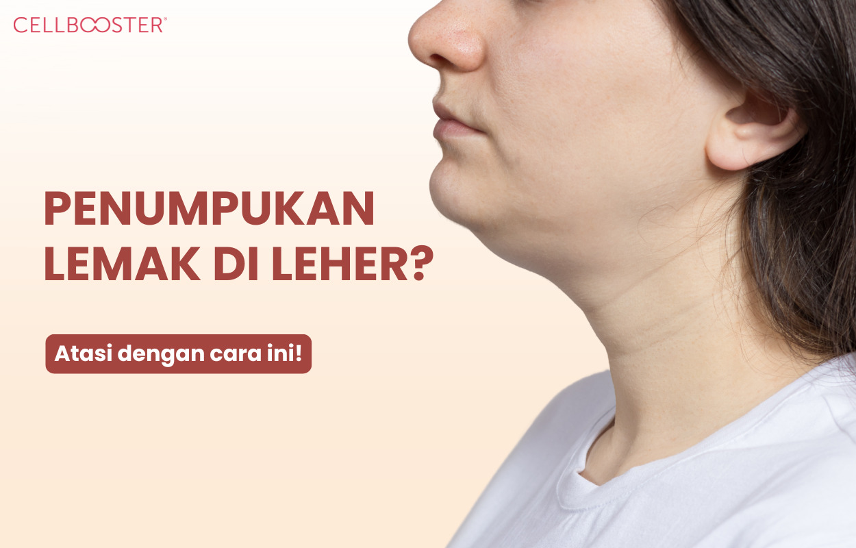 Cara Hilangkan Lemak di Leher