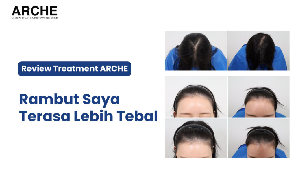 Perawatan Rambut Rontok Keenam
