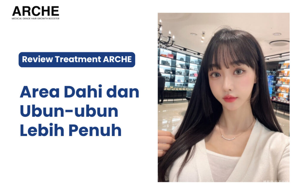 Kerontokan Rambut pada Wanita
