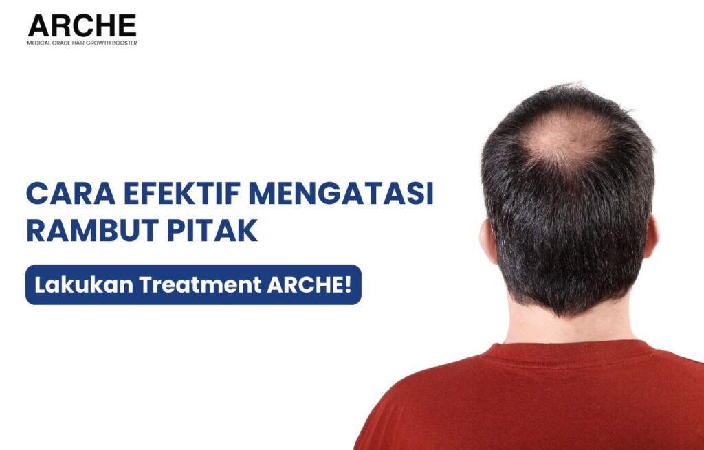 cara mengatasi rambut pitak