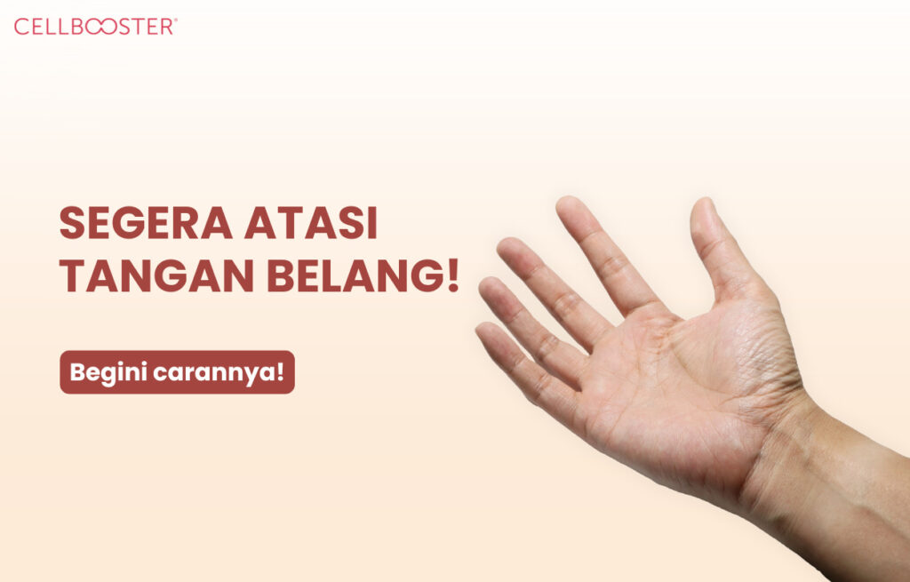 Cara Menghilangkan Belang di Tangan