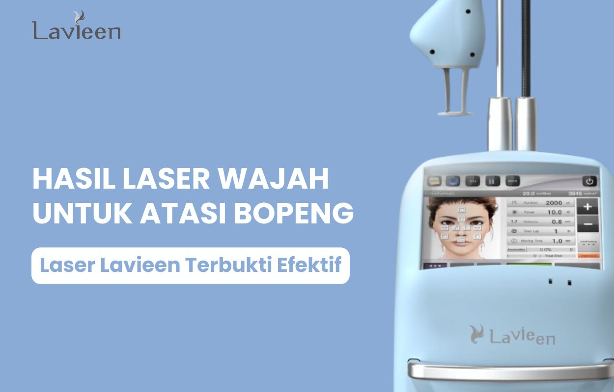 hasil laser wajah bopeng