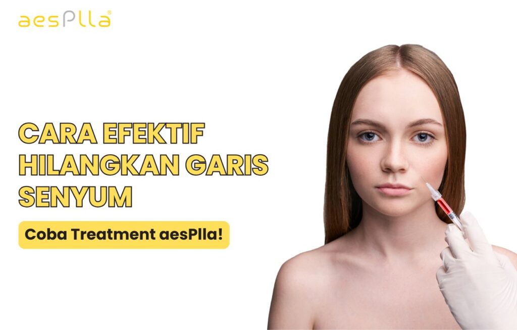 garis senyum di wajah