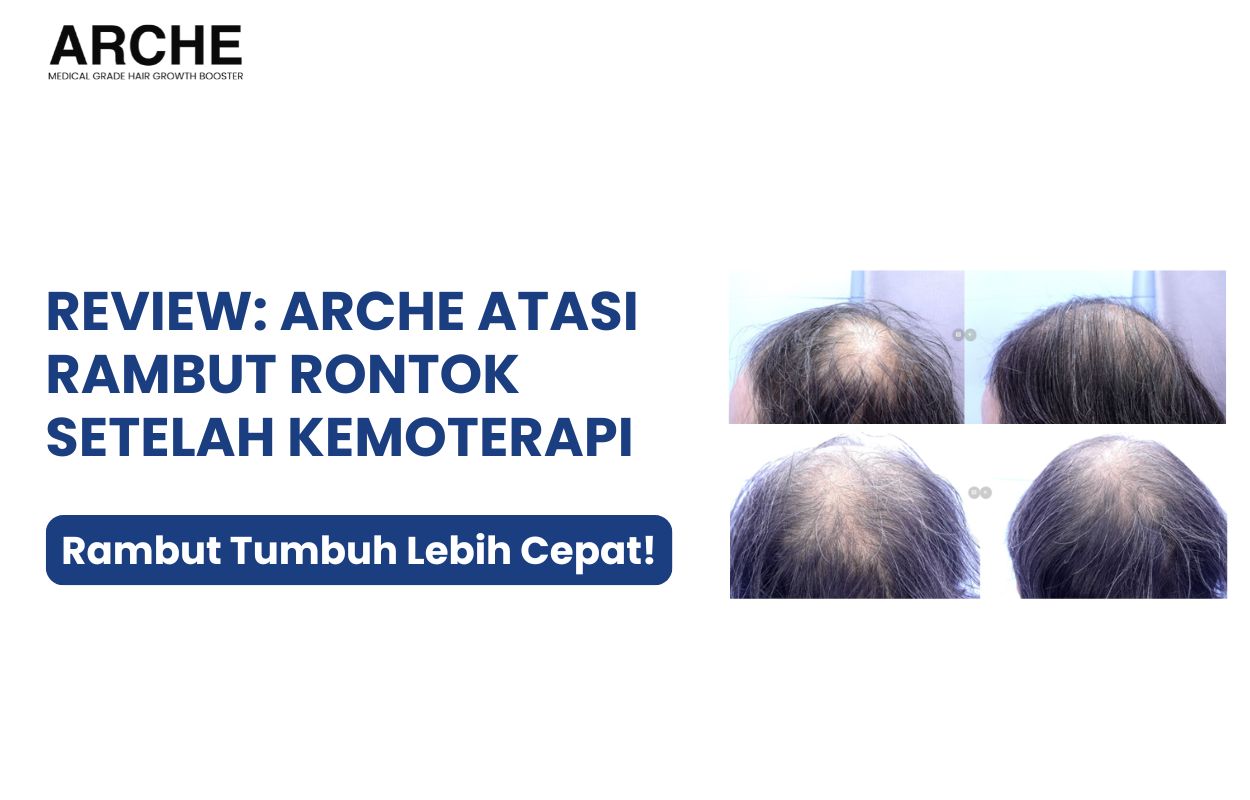 atasi rambut rontok
