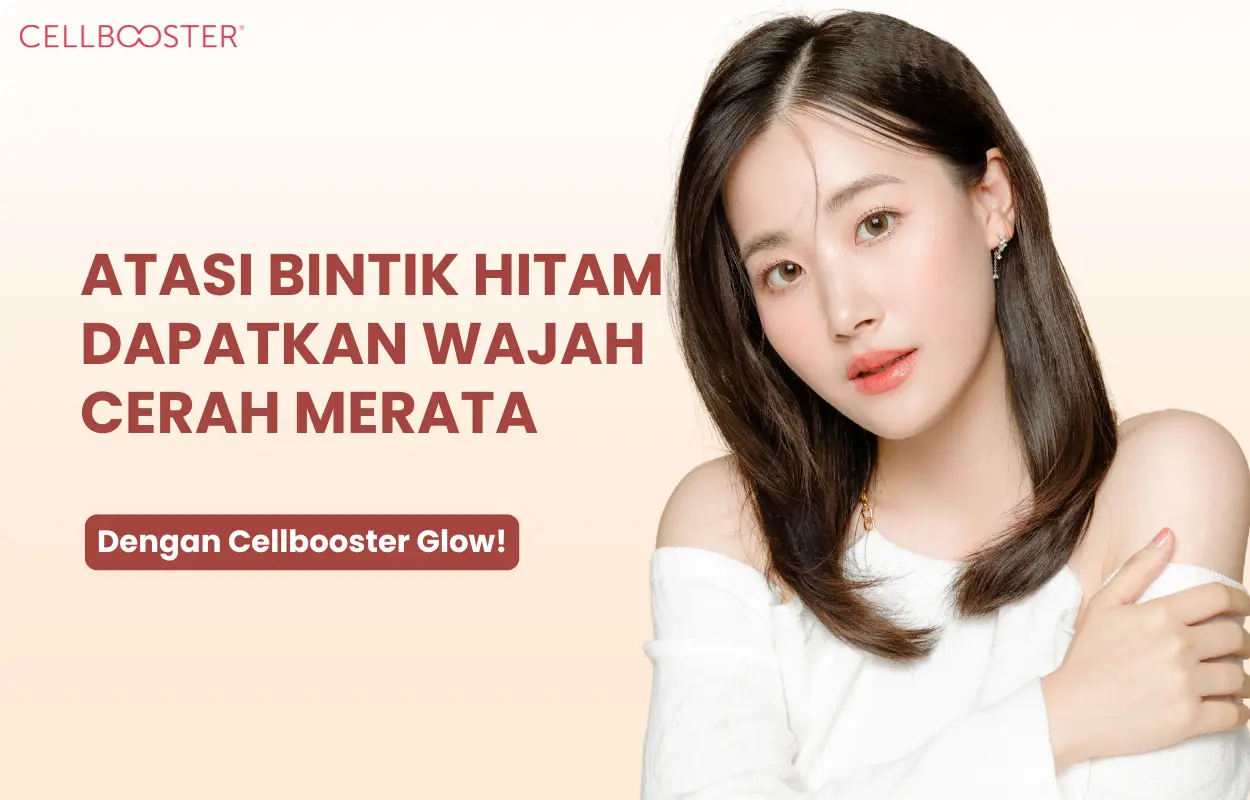 Cara Mengatasi Bintik Hitam di Wajah