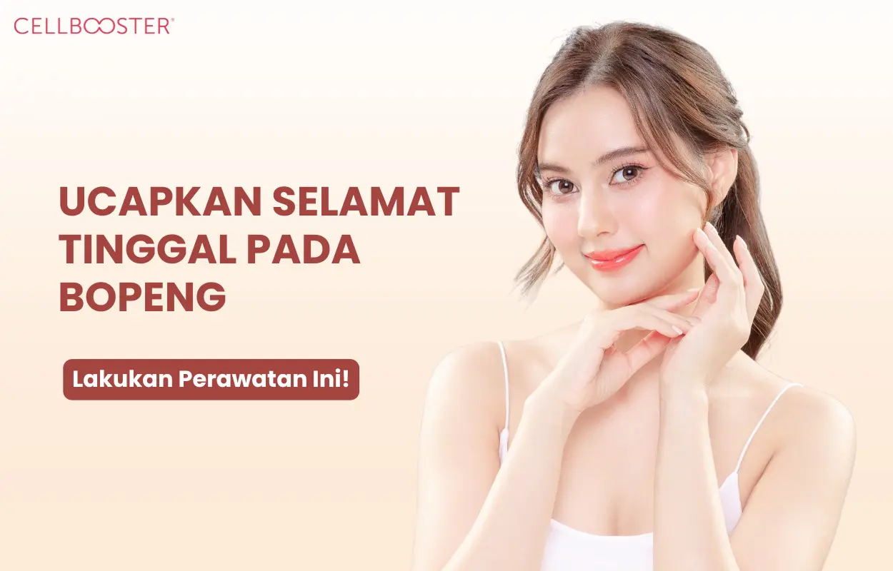 Perawatan Bopeng