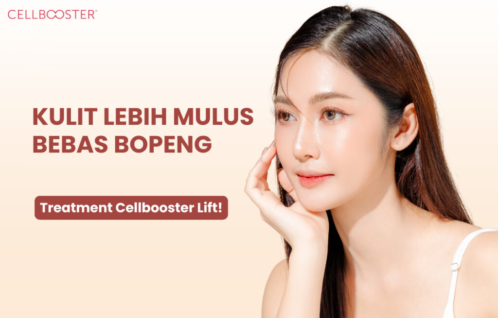 Cara Mengatasi Bopeng Bekas Jerawat secara Alami