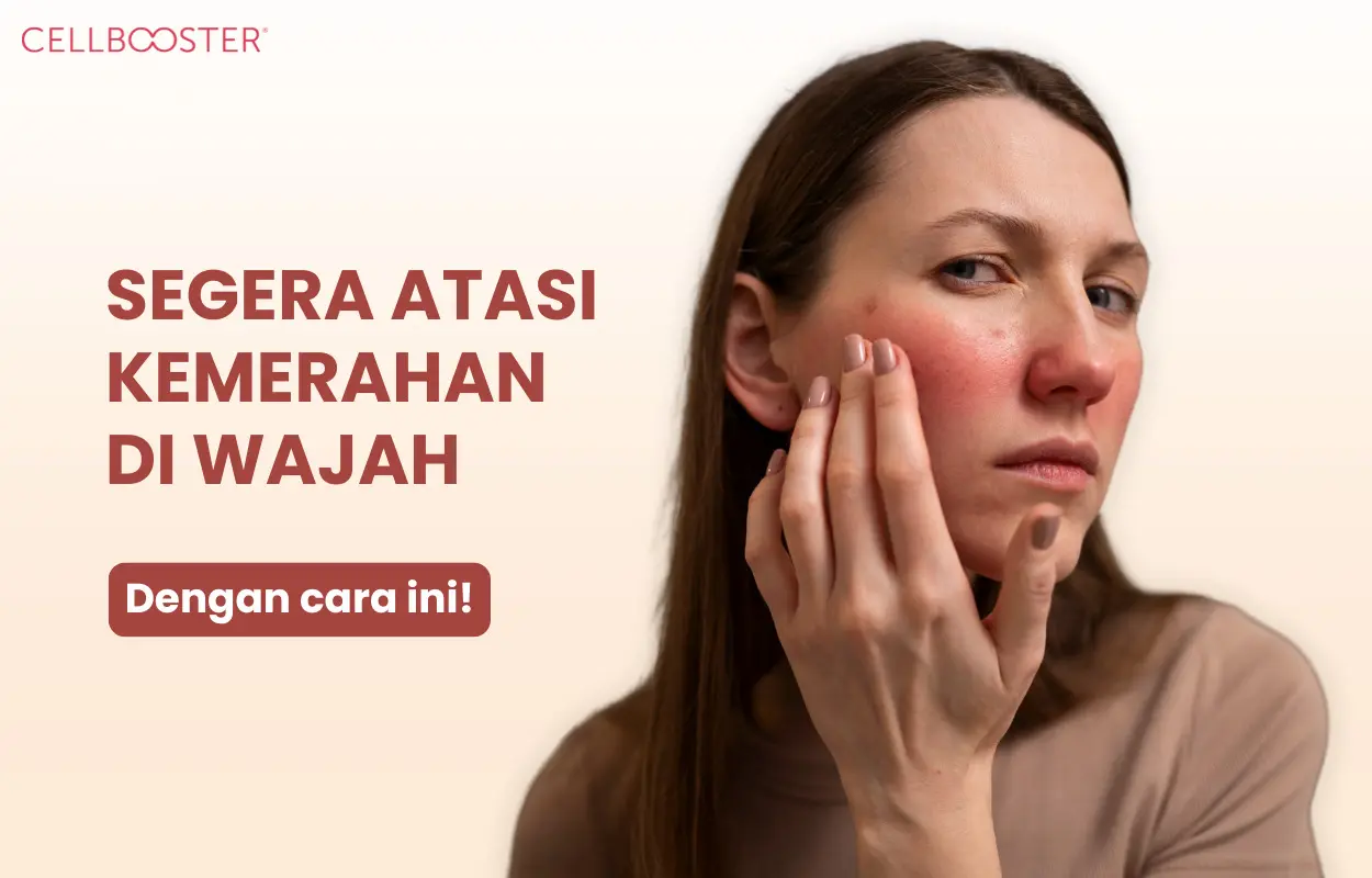 Kemerahan di Wajah