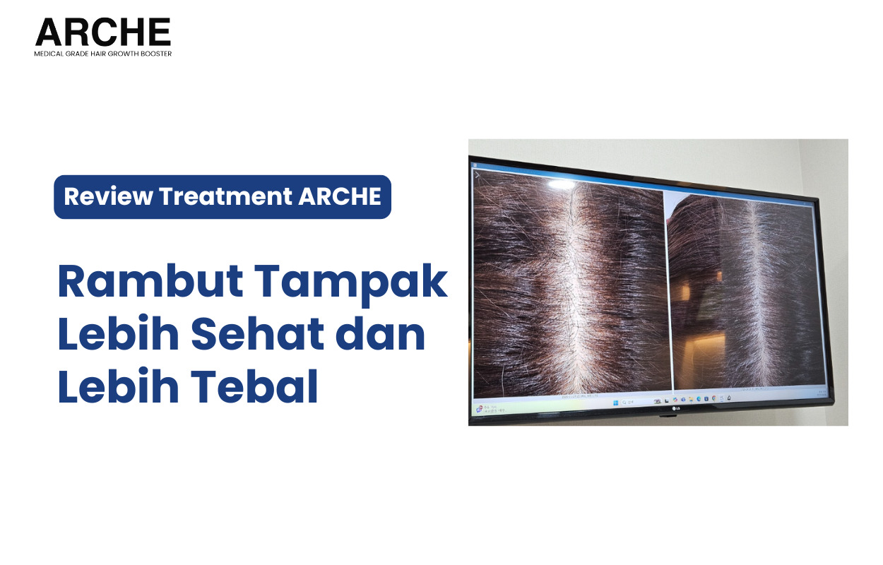 Rambut Mengalami Kerontokan