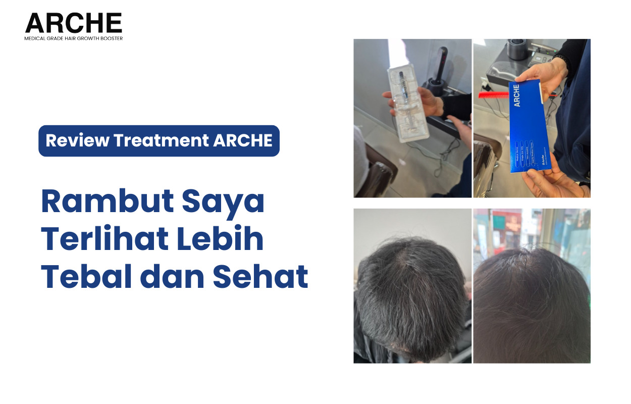 Garis Rambut