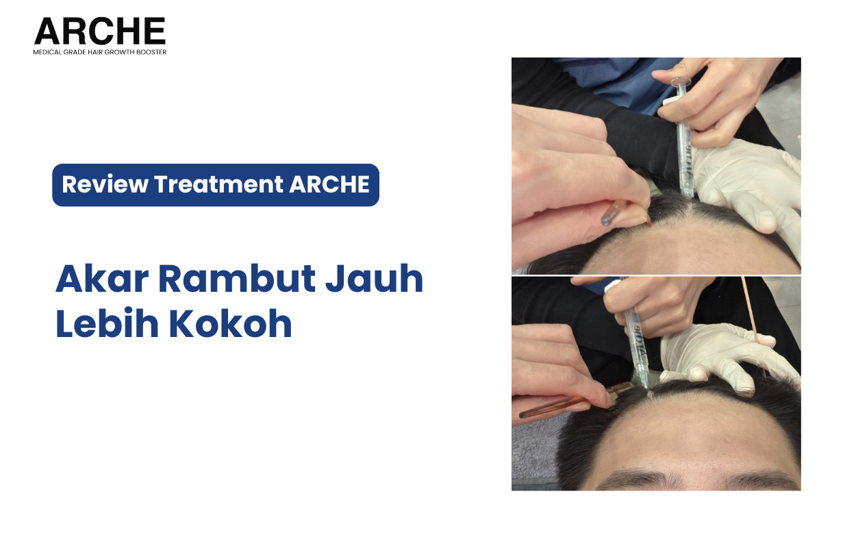Perawatan Rambut Rontok Menggunakan ARCHE
