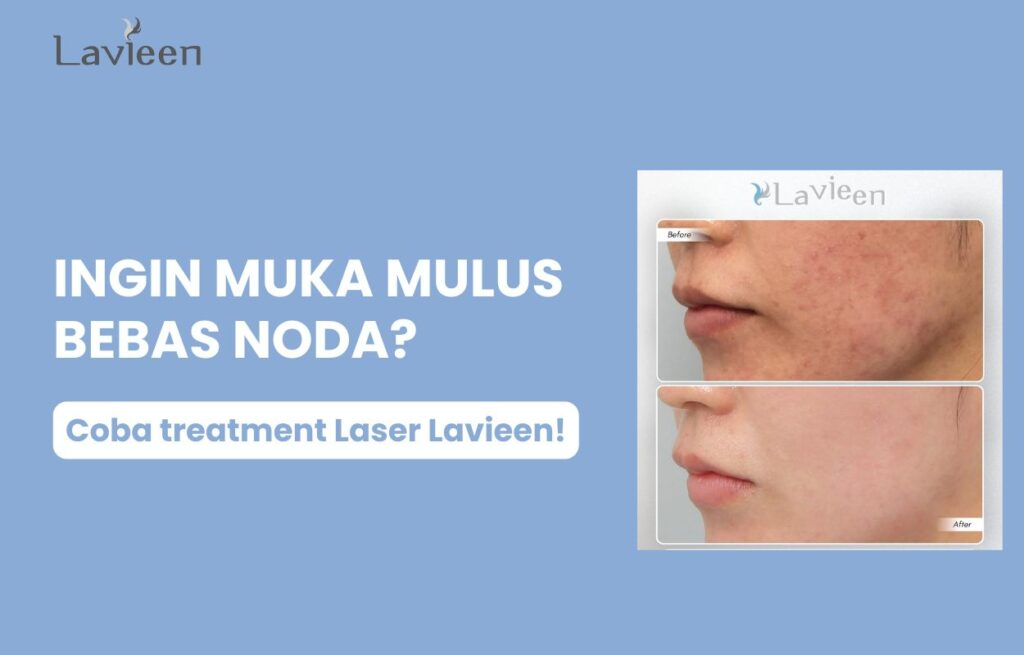 muka mulus