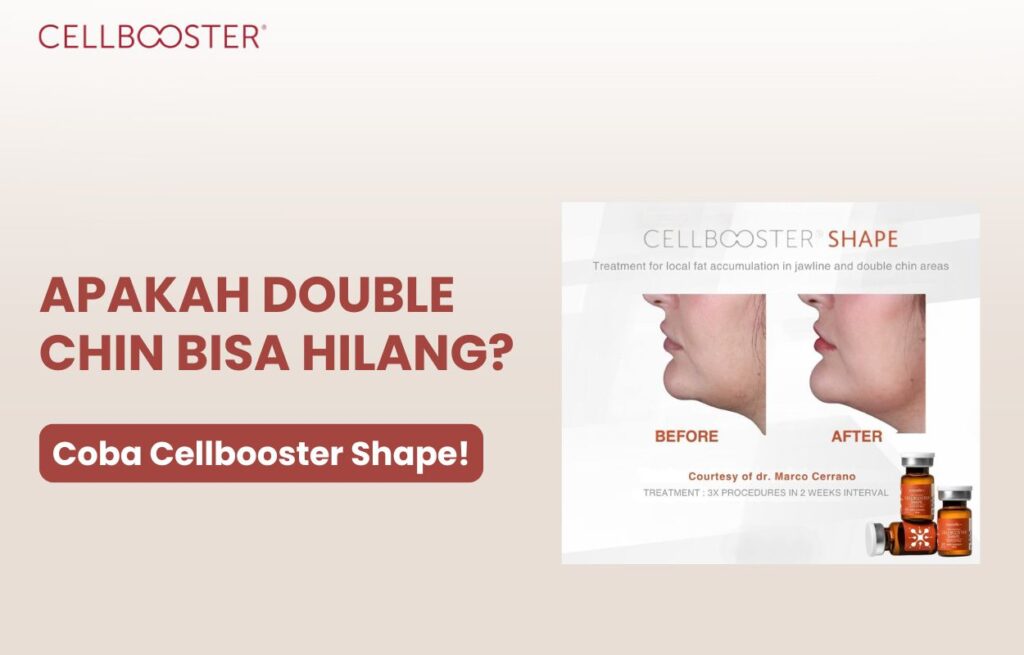 Apakah double chin bisa hilang