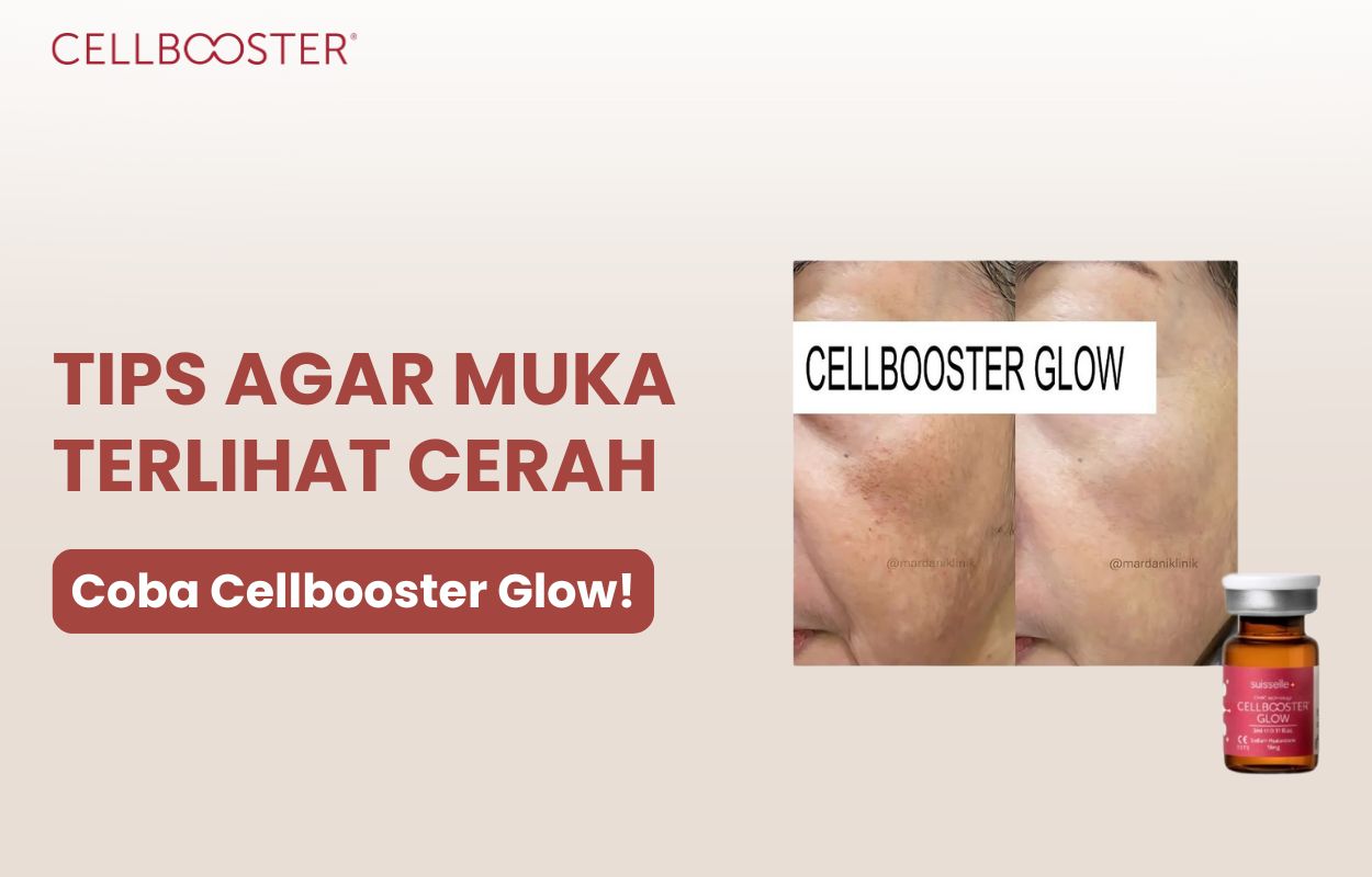muka cerah