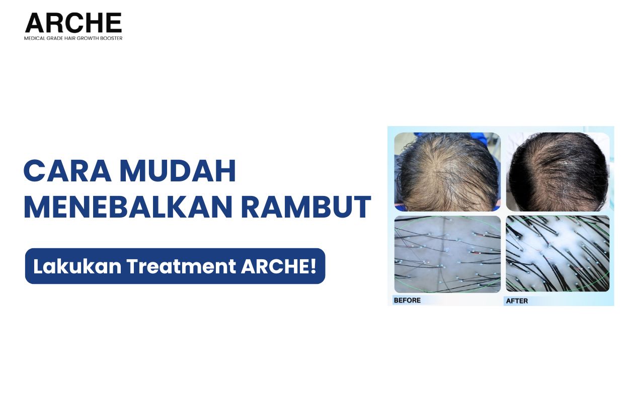 cara biar rambut tebal