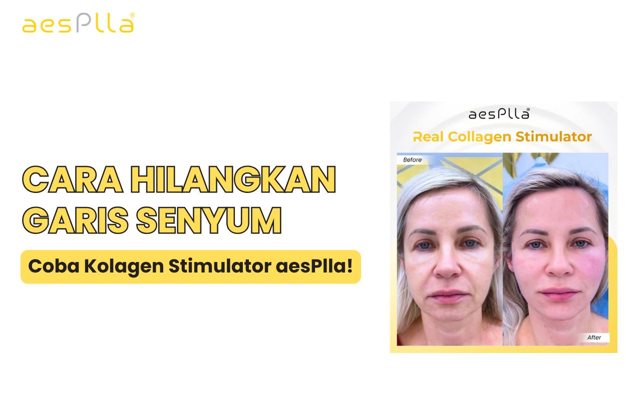 garis senyum di pipi