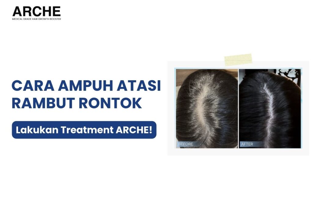 cara menyembuhkan rambut rontok