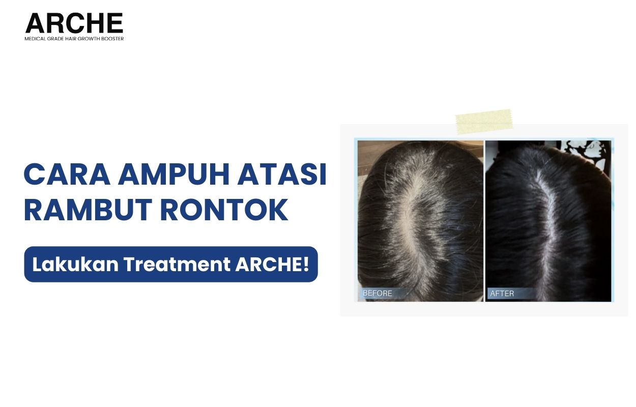 cara menyembuhkan rambut rontok