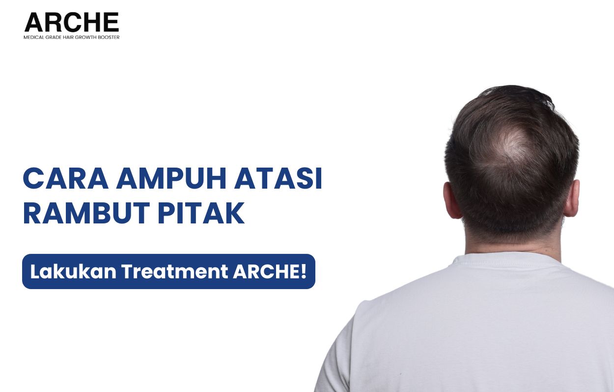 pitak di kepala
