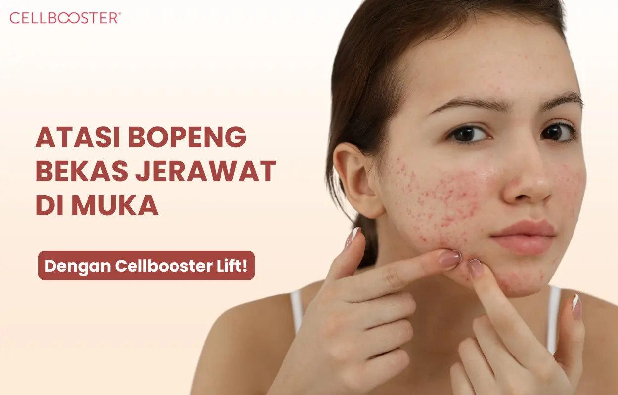 bopeng muka
