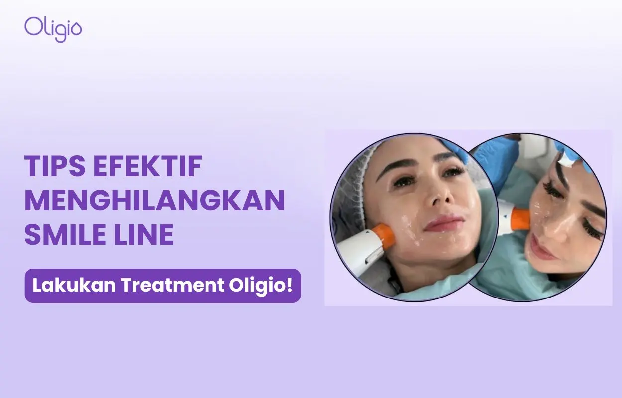 cara menghilangkan smile line di wajah
