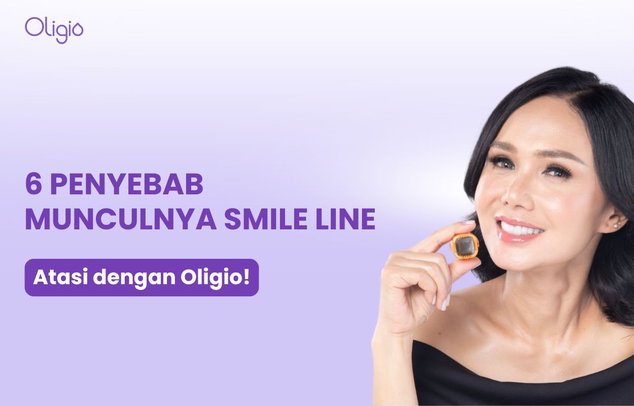 penyebab smile line