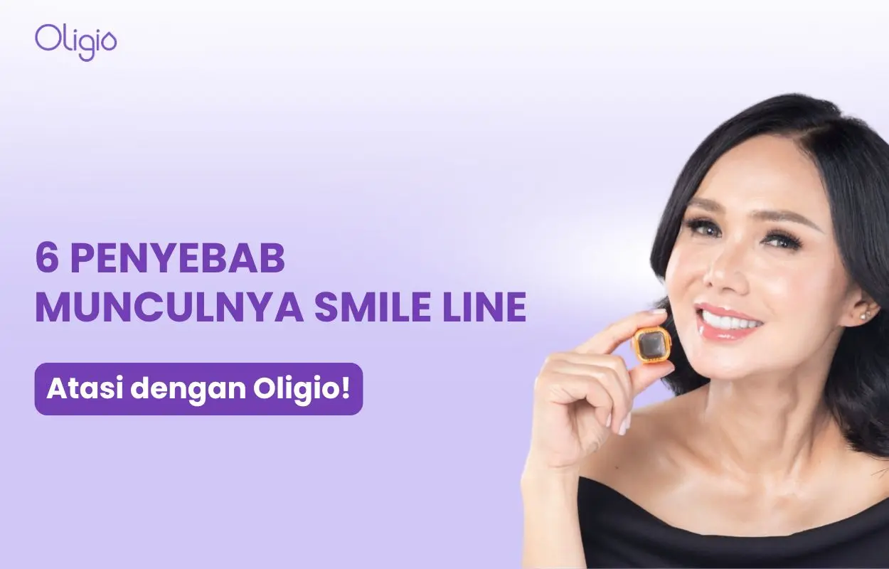 penyebab smile line