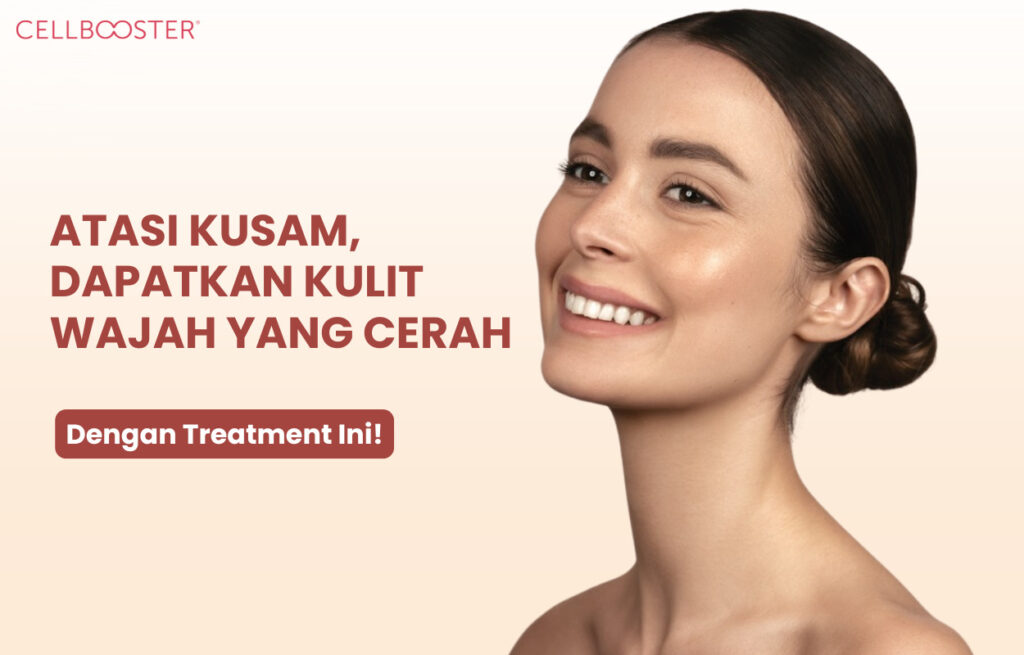 mengapa wajah kusam