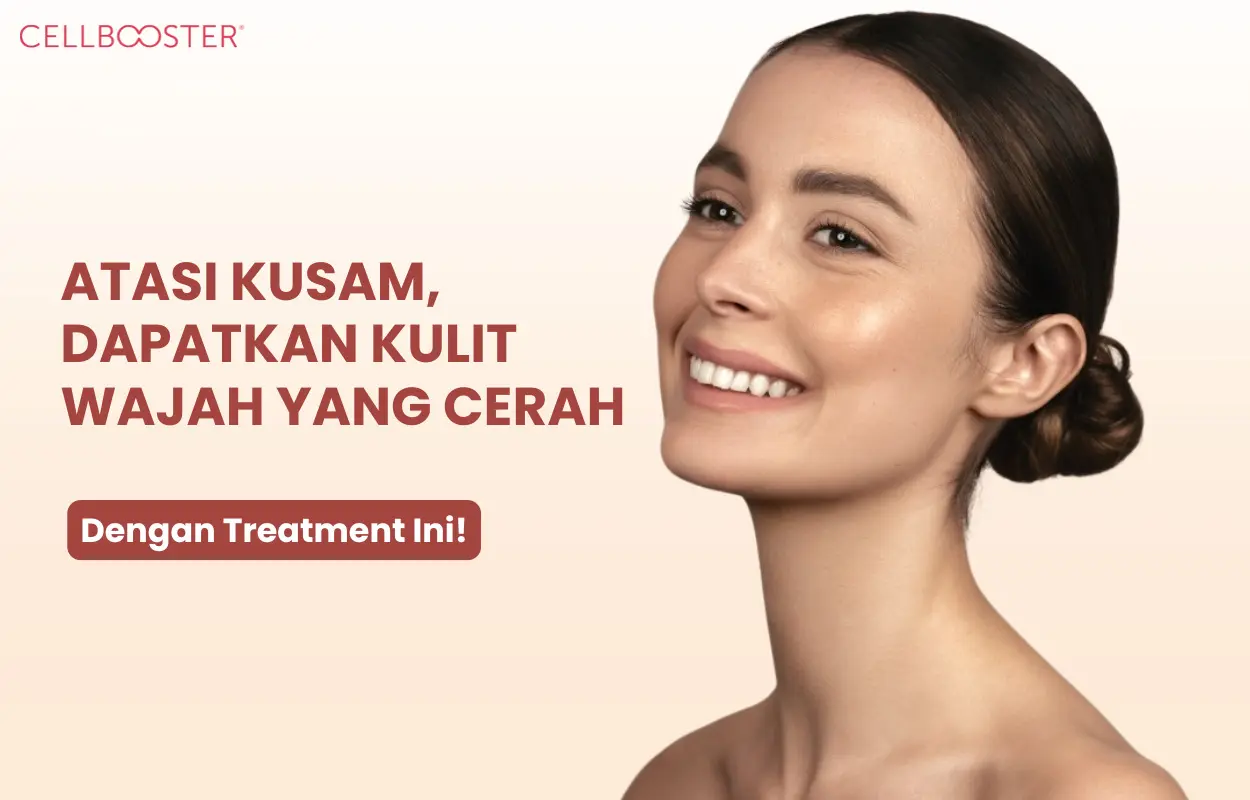 mengapa wajah kusam