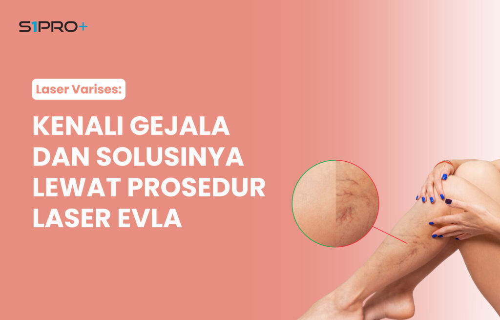 laser evla