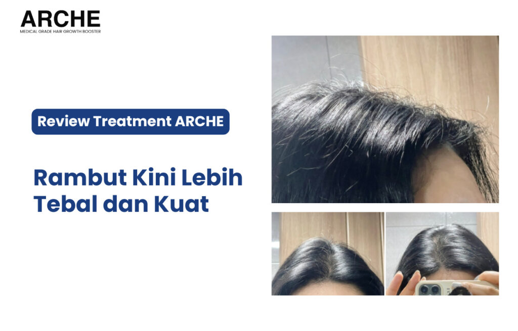 perawatan dengan arche