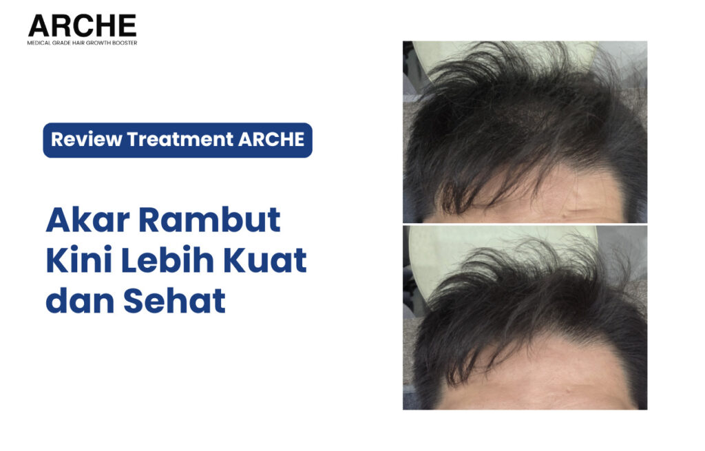 sesi perawatan rambut rontok