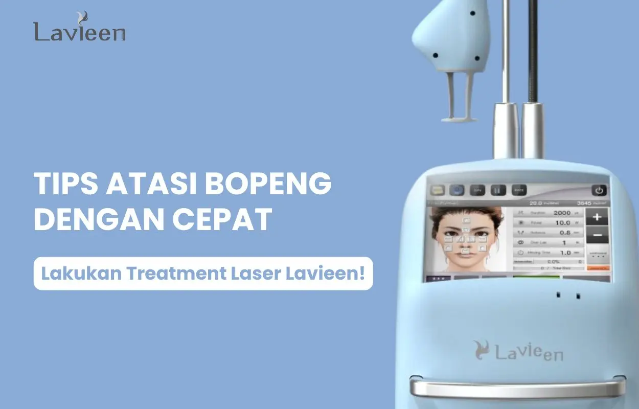 cara mengatasi muka bopeng