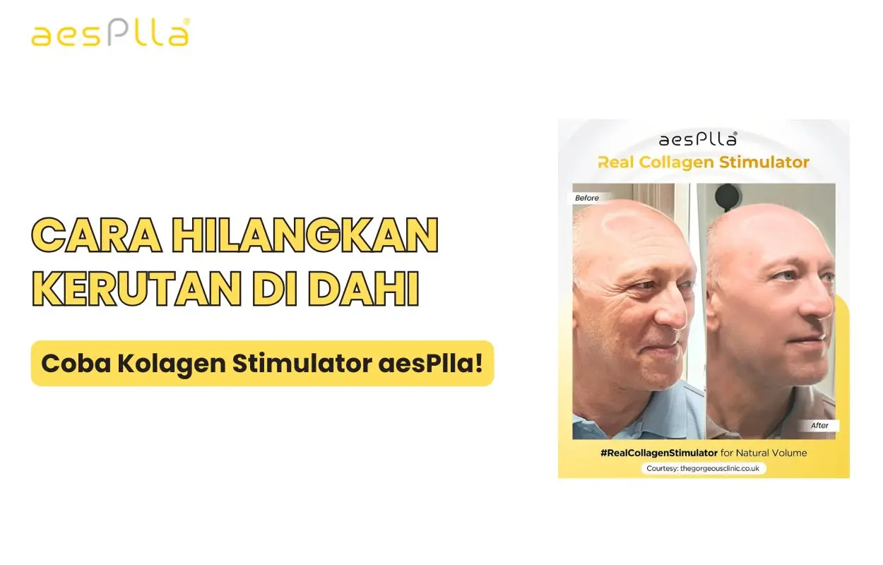 cara menghilangkan kerutan di jidat