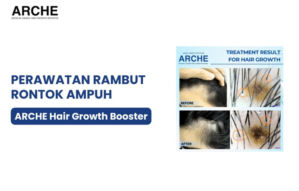 perawatan rambut rontok dan ketombe