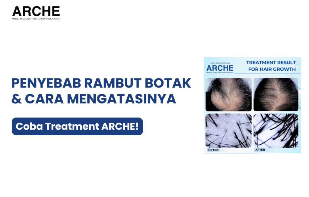 penyebab rambut rontok