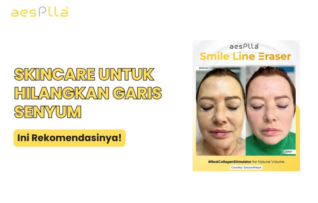 skincare untuk menghilangkan garis senyum