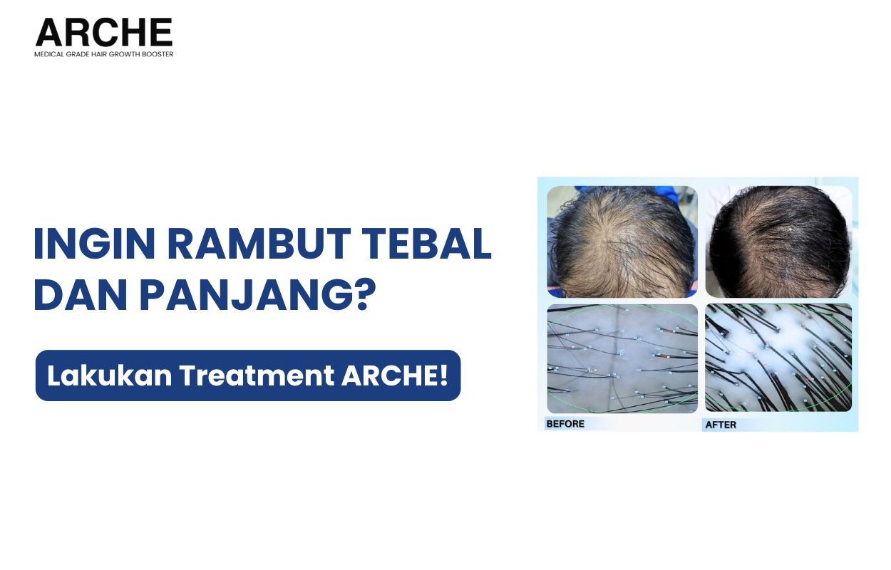 cara rambut tebal