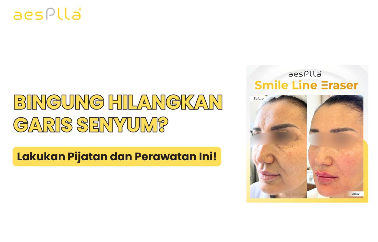 pijatan menghilangkan garis senyum