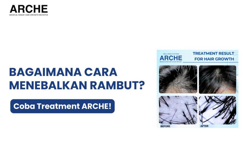 apakah rambut tipis bisa tebal