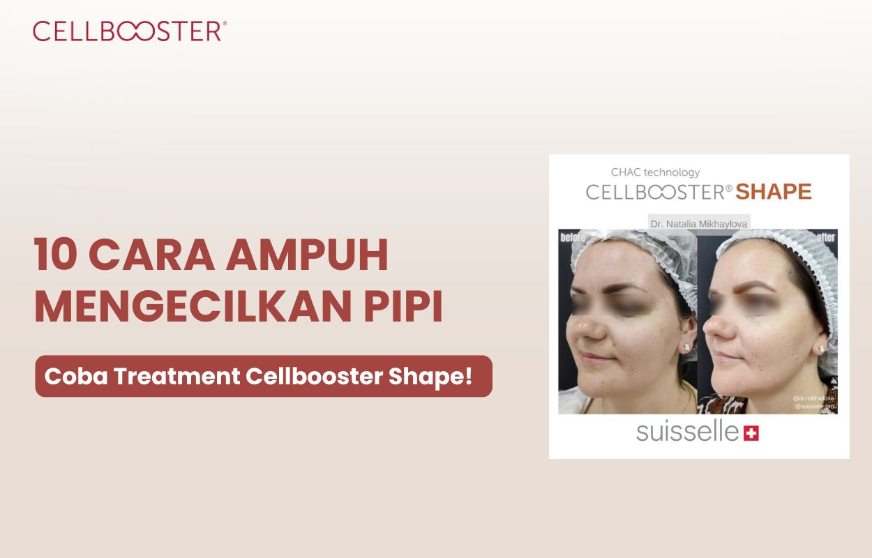 cara mengecilkan pipi dengan cepat