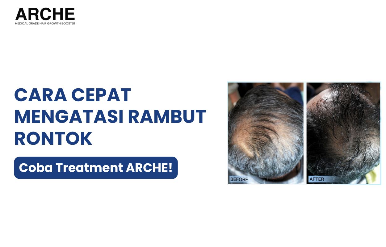 cara menumbuhkan rambut rontok
