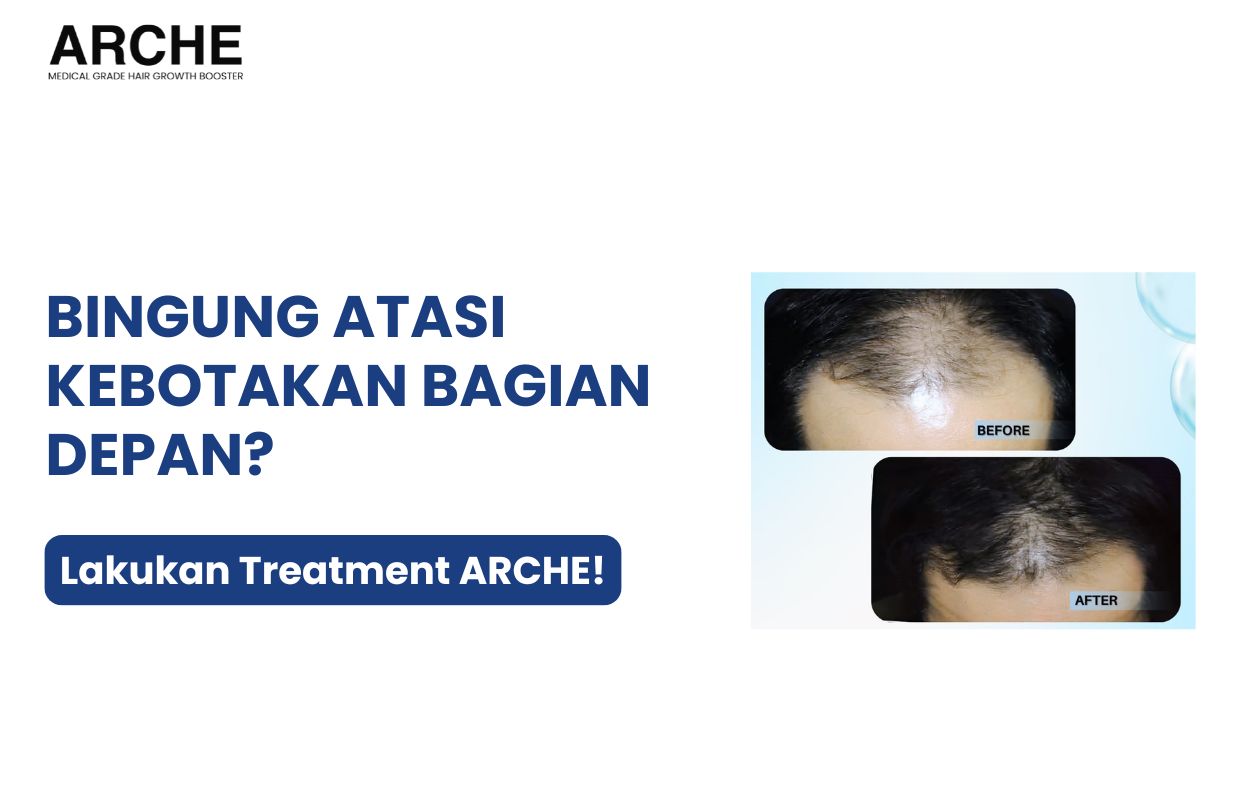 obat penumbuh rambut botak